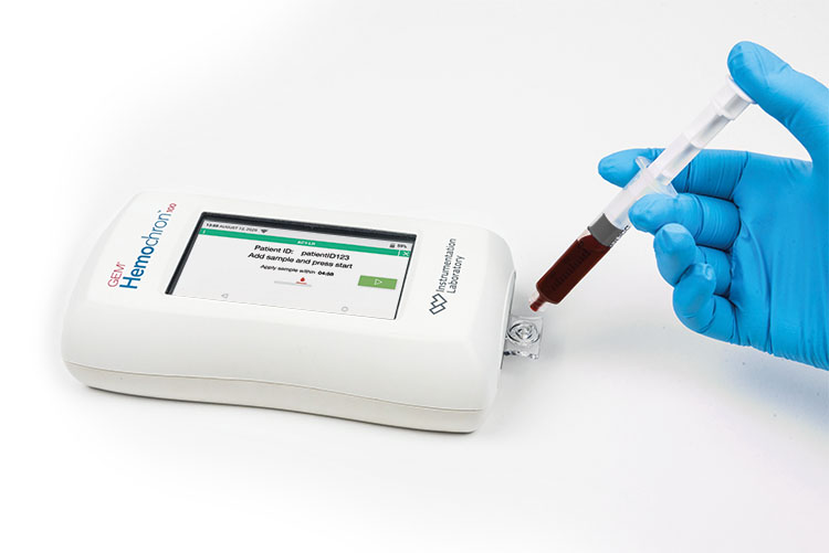 Beschleunigtes HeparinMonitoring ManagementKrankenhaus